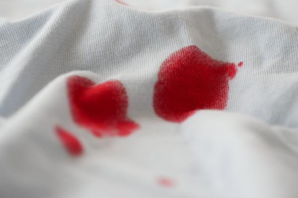 ¿Manchas de sangre en la ropa? Así puedes eliminarlas paso a paso con ayuda del vapor
