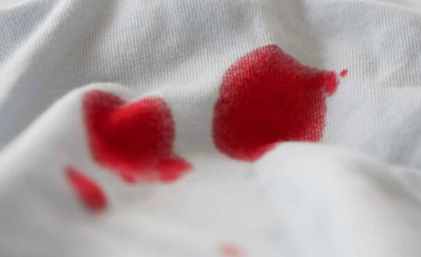 Manchas de sangue na roupa? Veja como eliminá-las passo a passo com a ajuda do vapor
